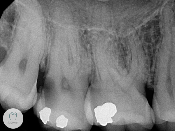 Pre-treatment x-ray