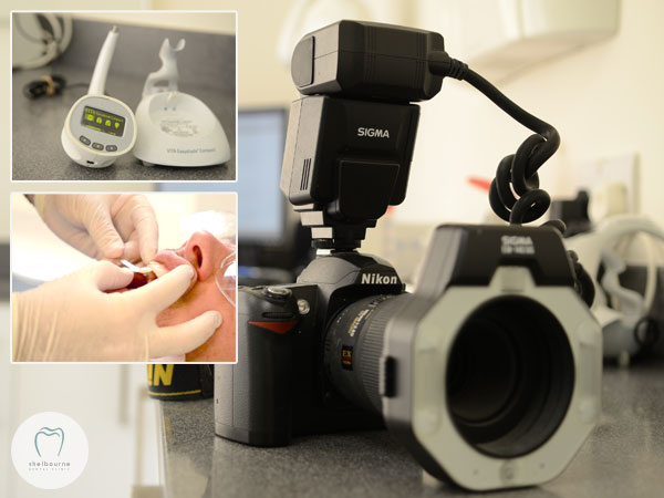Dental Digital Camera